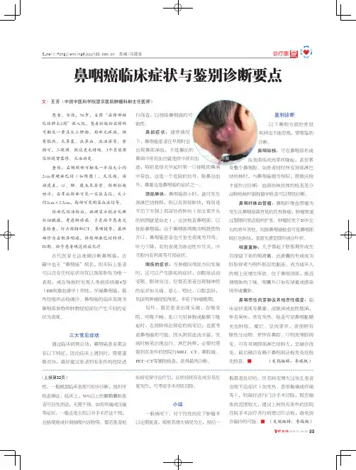 鼻咽癌临床症状与鉴别诊断要点