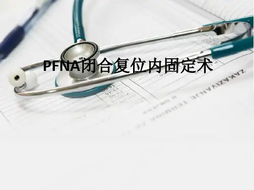 PFNA闭合复位内固定术ppt课件