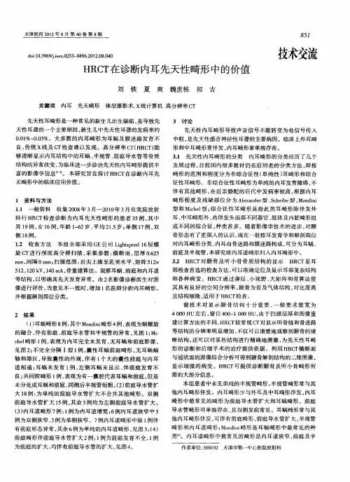 HRCT在诊断内耳先天性畸形中的价值