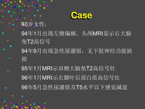 多发性硬化PPT课件