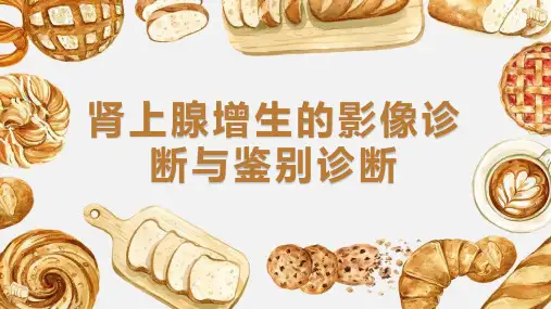 肾上腺增生的影像诊断与鉴别诊断