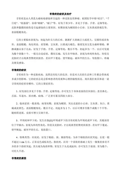 寻常疣的症状及治疗