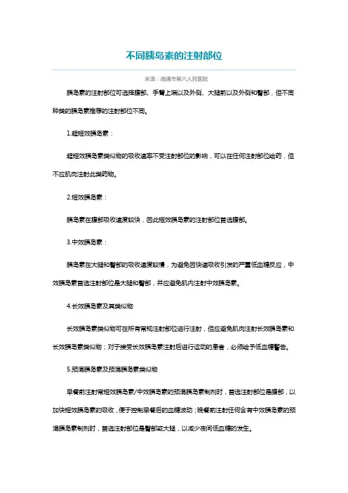 不同胰岛素的注射部位