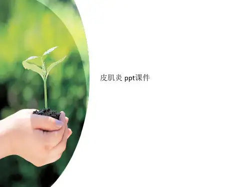 皮肌炎 ppt课件