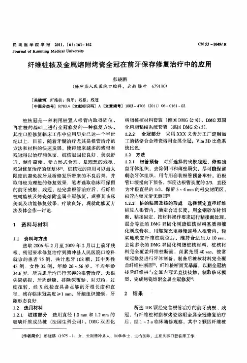 纤维桩核及金属熔附烤瓷全冠在前牙保存修复治疗中的应用