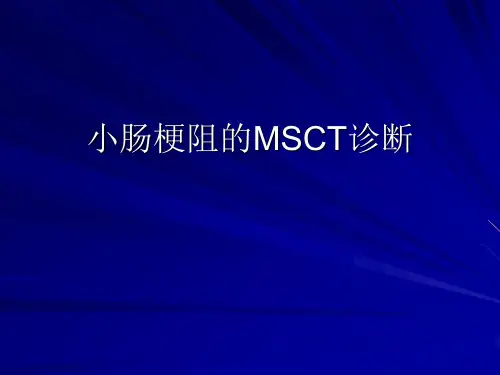 小肠梗阻诊断PPT课件