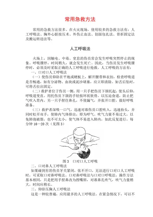 常用急救方法