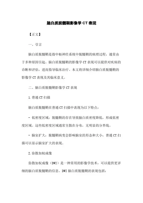 脑白质脱髓鞘影像学CT表现