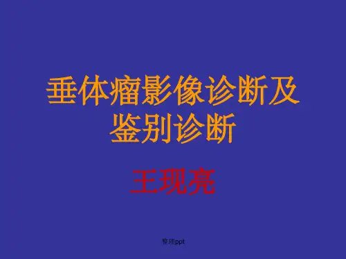 垂体腺瘤及其鉴别诊断