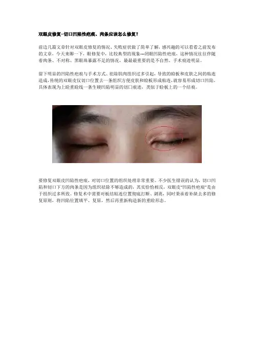 双眼皮修复--切口凹陷性疤痕、肉条应该怎么修复