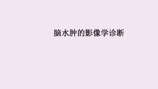脑水肿的影像学诊断