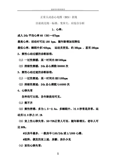 正常人动态心电图