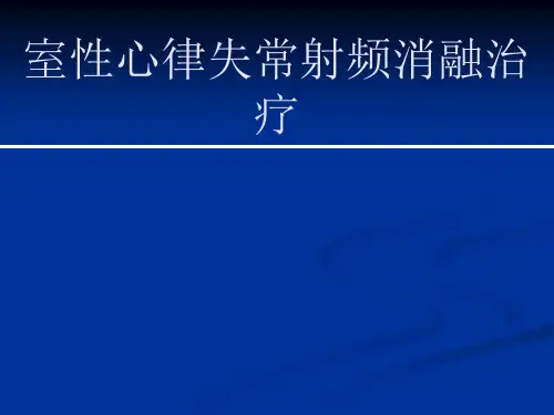 室性心律失常射频消融治疗