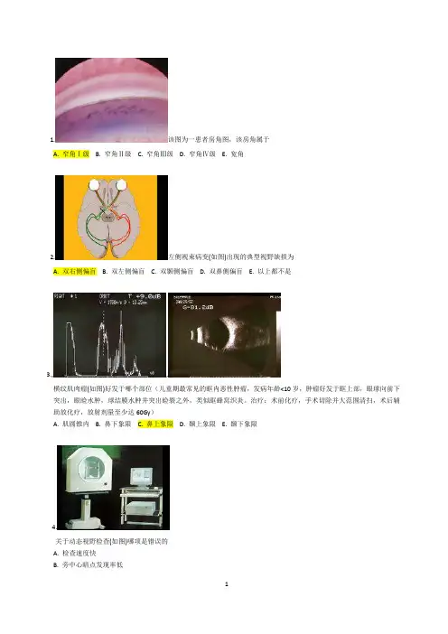 眼科--规培模拟题含答案 全 288题