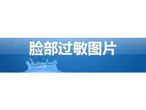 脸部过敏图片PPT优秀课件