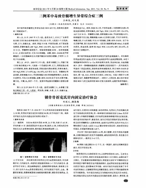 锁骨骨折克氏针内固定治疗体会