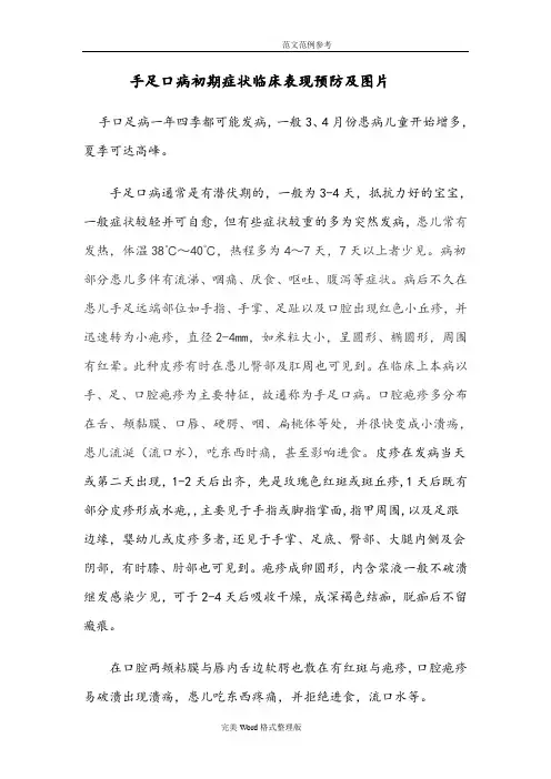 手足口病初期症状及图片