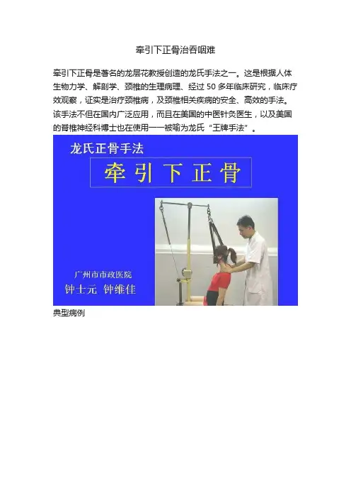 牵引下正骨治吞咽难