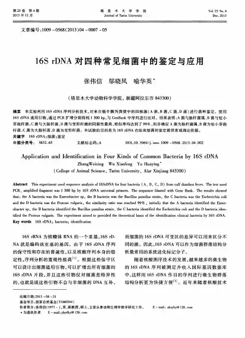 16SrDNA对四种常见细菌中的鉴定与应用