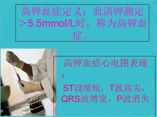 高钾血症病人护理查房(共7张PPT)