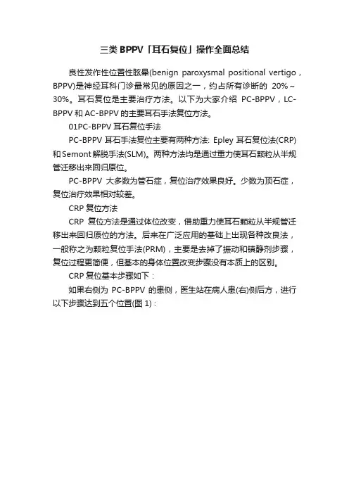 三类BPPV「耳石复位」操作全面总结