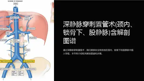 深静脉穿刺置管术(颈内、锁骨下、股静脉)含解剖图谱