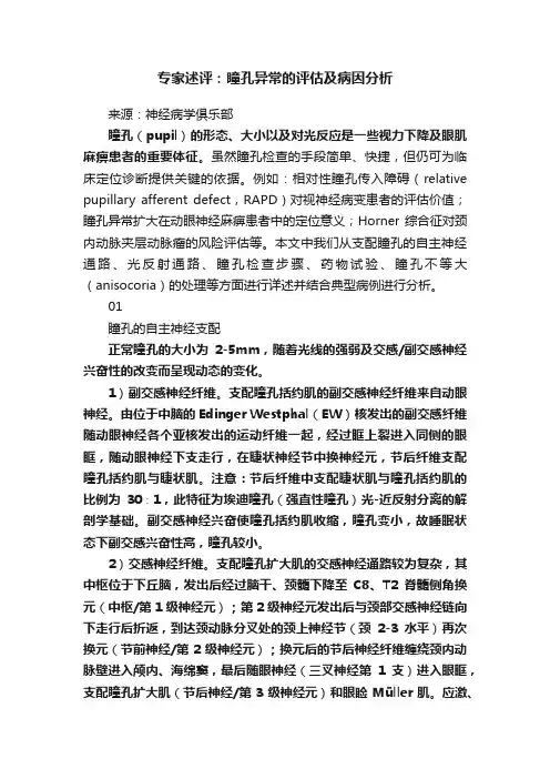 专家述评：瞳孔异常的评估及病因分析