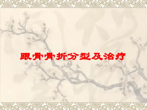 跟骨骨折分型及治疗培训课件