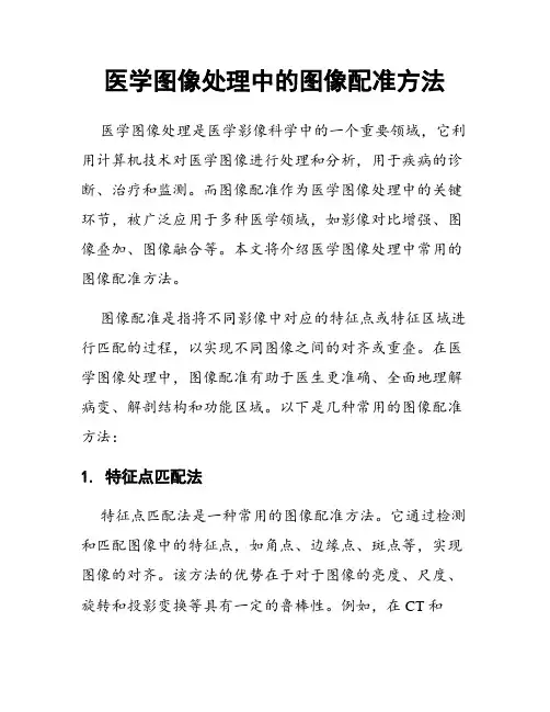 医学图像处理中的图像配准方法