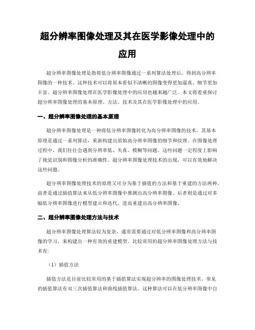 超分辨率图像处理及其在医学影像处理中的应用