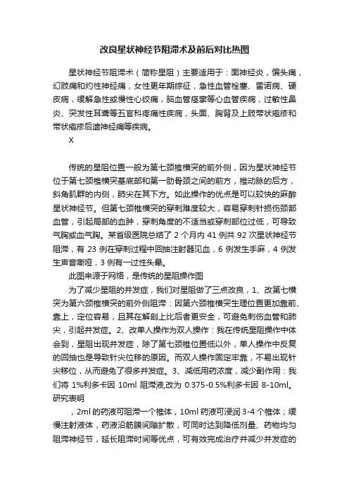 改良星状神经节阻滞术及前后对比热图