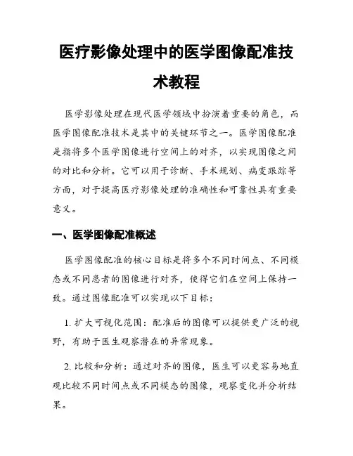 医疗影像处理中的医学图像配准技术教程