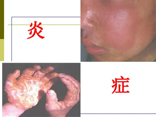 炎症分类,结局、意义(讲义)