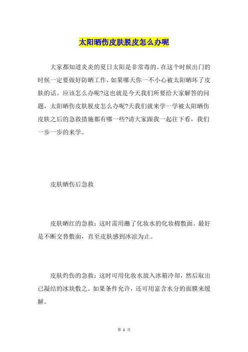 太阳晒伤皮肤脱皮怎么办呢