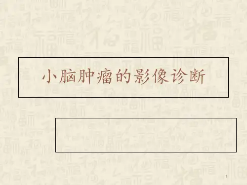小脑肿瘤的影像诊断  ppt课件
