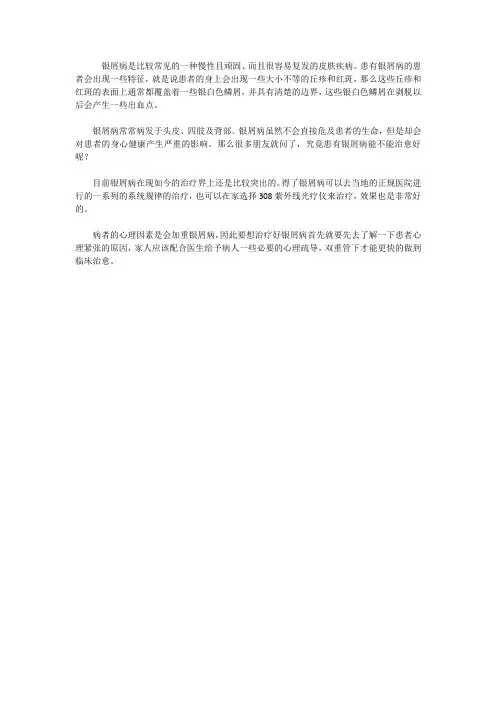 银屑病能治愈好吗？