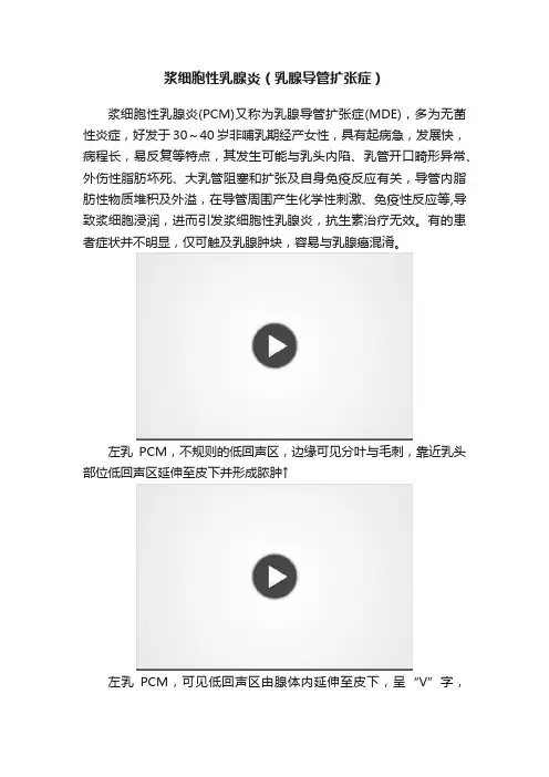 浆细胞性乳腺炎（乳腺导管扩张症）