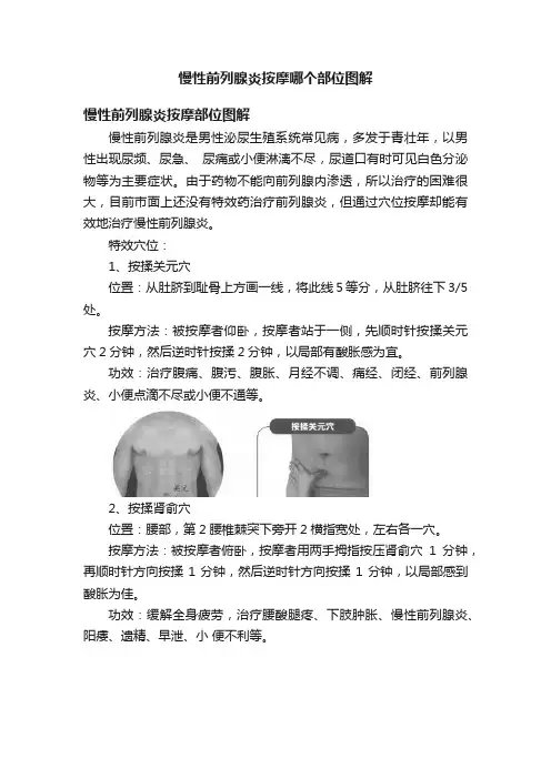 慢性前列腺炎按摩哪个部位图解