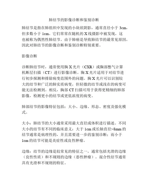 肺结节的影像诊断和鉴别诊断