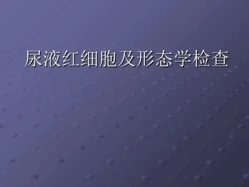 尿液红细胞及形态-PPT课件