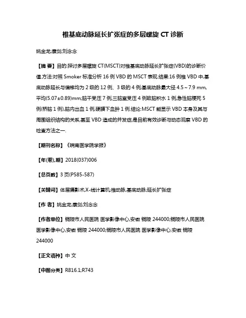 椎基底动脉延长扩张症的多层螺旋CT诊断