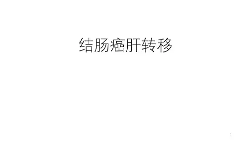 结肠癌肝转移PPT课件