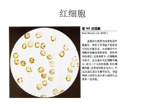 尿液形态学图片