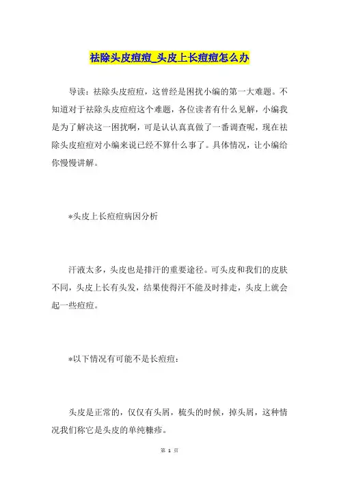 祛除头皮痘痘头皮上长痘痘怎么办