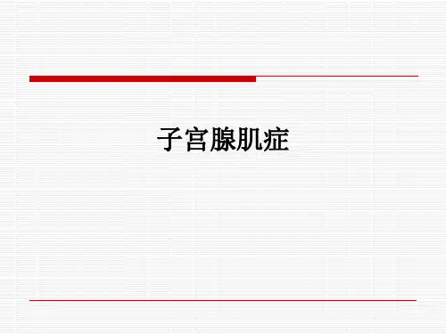 子宫腺肌症ppt课件