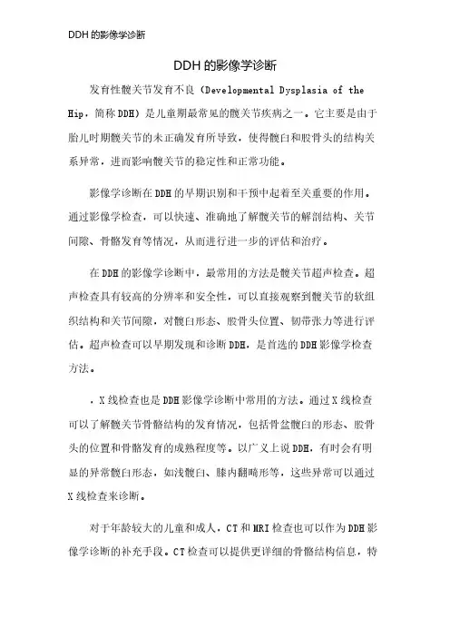 DDH的影像学诊断
