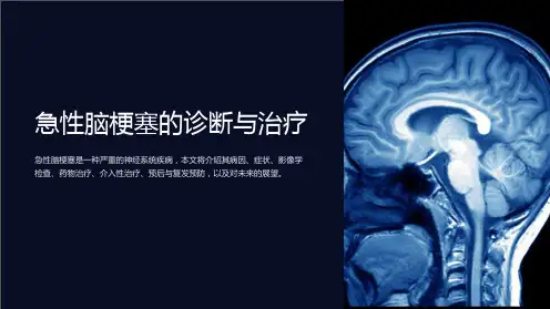 急性脑梗塞的诊断与治疗