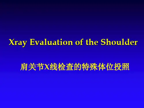 肩关节X线拍照方法