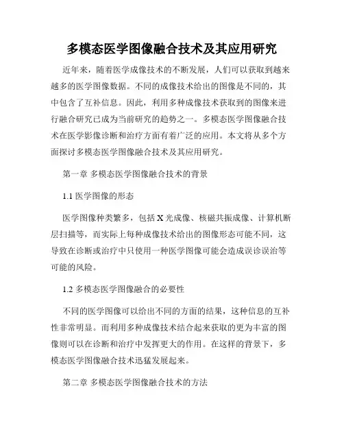 多模态医学图像融合技术及其应用研究