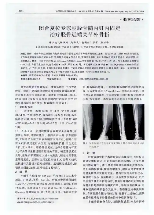 闭合复位专家型胫骨髓内钉内固定治疗胫骨远端关节外骨折